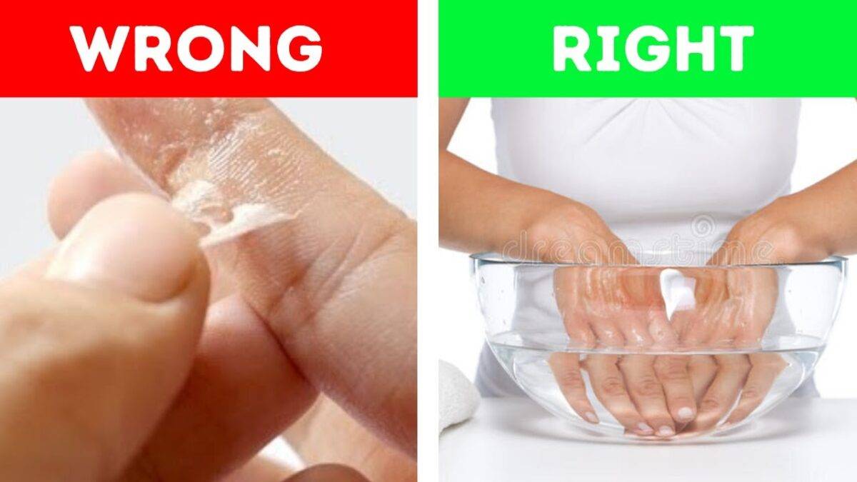 Cách tẩy keo 502 trên nhựa, da tay